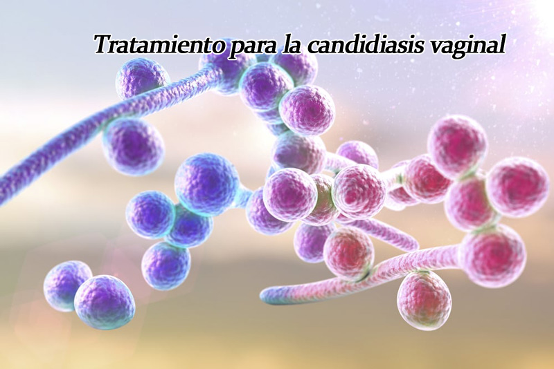 Tratamiento para la candidiasis vaginal: Guía completa y efectiva